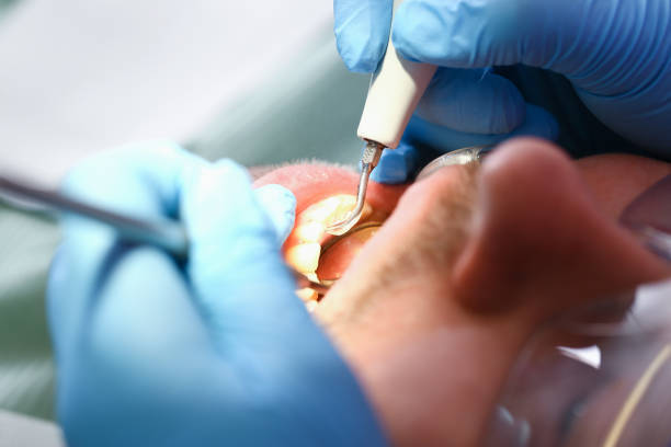 Best Emergency Dental Care for Abscessed Tooth in Winfield, TN