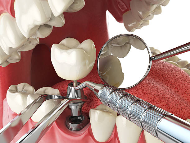 Best Mobile Emergency Dentist in Winfield, TN