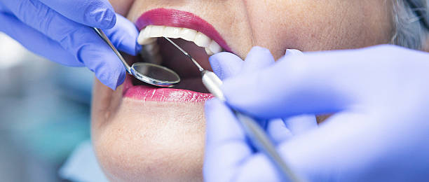 Best Emergency Root Canal Treatment in Winfield, TN