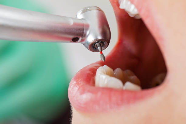 Best Weekend Emergency Dentist in Winfield, TN